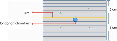 Assessment of Delivery Quality Assurance for Stereotactic Radiosurgery With Cyberknife